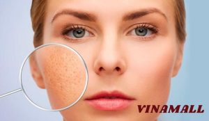 cách chọn mỹ phẩm cho da dầu