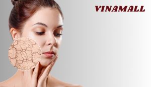 cách chọn mỹ phẩm cho da khô